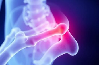 Эвиста и кости: как ралоксифен помогает в профилактике остеопороза