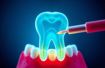Пульпит: тревожный сигнал зуба, который нельзя игнорировать